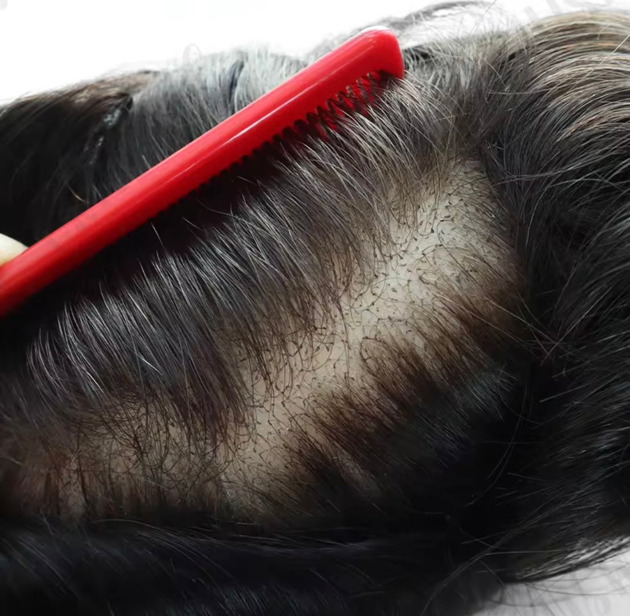 Mens Hair Topper - Swiss lace topper